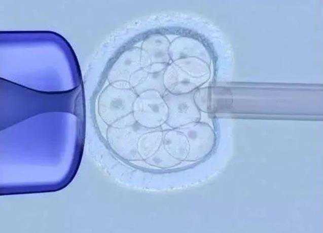 试管婴儿的进化：第三代试管助孕技术揭秘