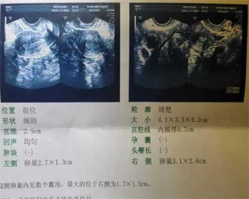 23吉安妇幼保健院试管婴儿费用及助孕省钱攻略