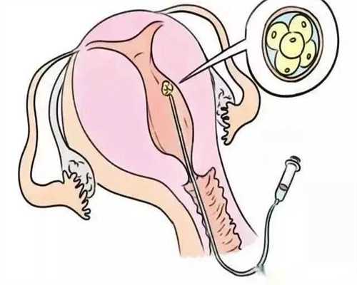 乌克兰做试管婴儿骗局，你想知道的都在这!乌克兰彼奥诊所试管婴儿费用一览